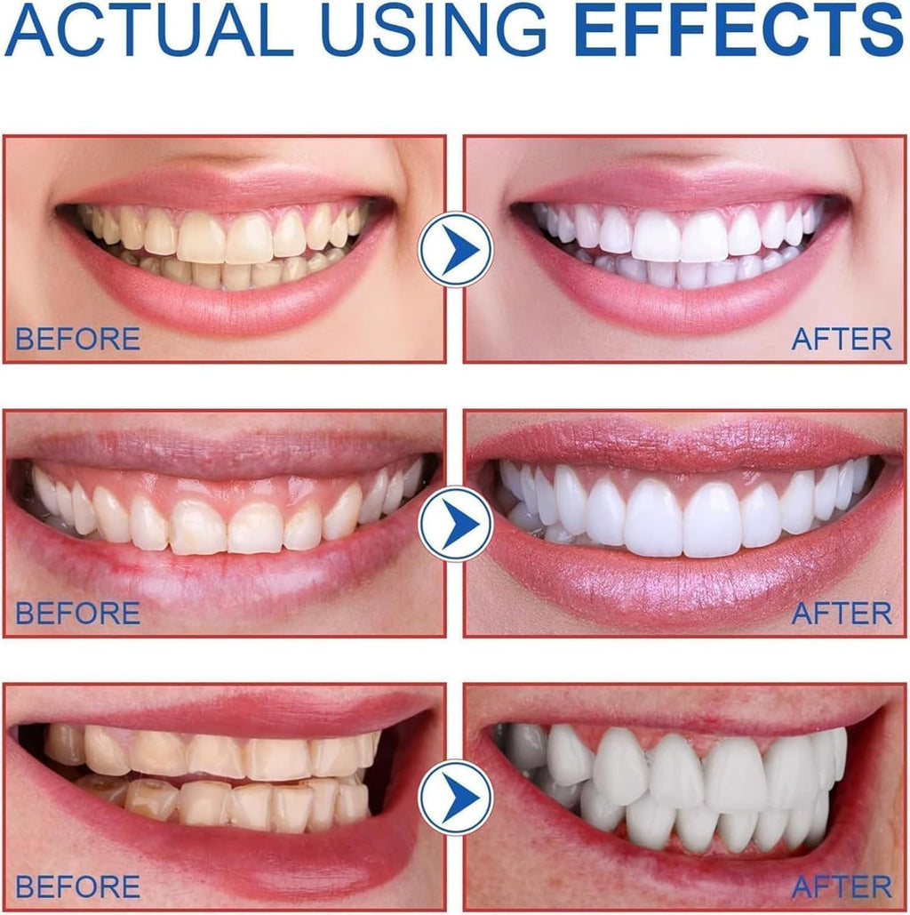 SP6 Probiotic Toothpaste, Ultra Whitening, Fresh Breath, Deep Clean