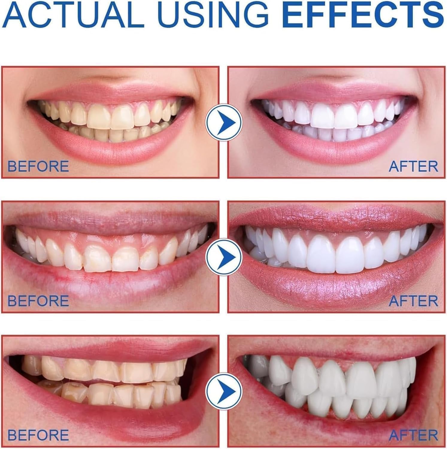 SP6 Probiotic Toothpaste, Ultra Whitening, Fresh Breath, Deep Clean